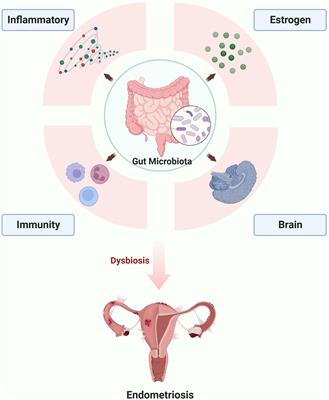 Role of the gut microbiota in the pathogenesis of endometriosis: a review
